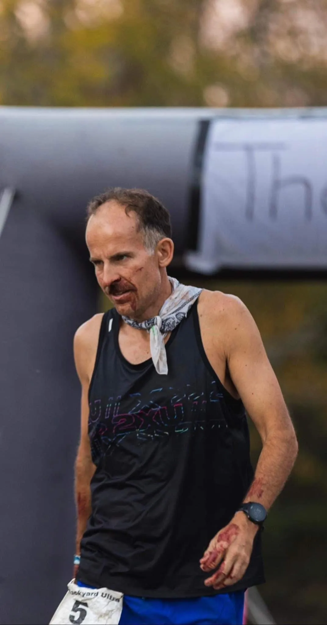 Harvey Lewis after finishing a backyard ultra, scraped but standing